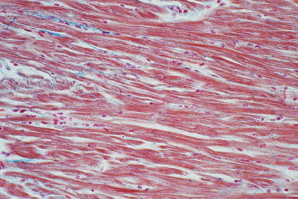 Tecido muscular.