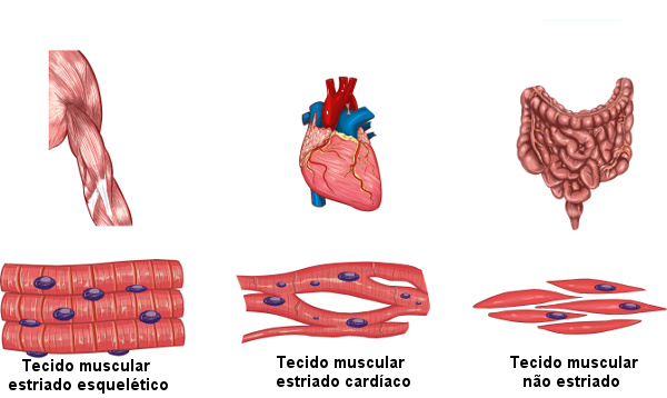 Os três tipos de tecido muscular existentes.