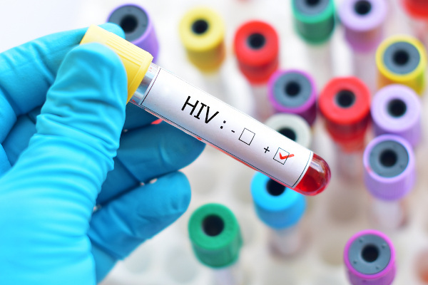 Pessoa com uma luva segurando um tubo com sangue e o rótulo de HIV positivo em referência à AIDS.
