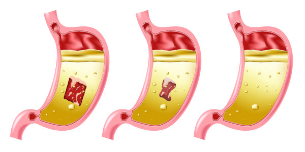 O suco gástrico é de fundamental importância no sistema digestivo. 