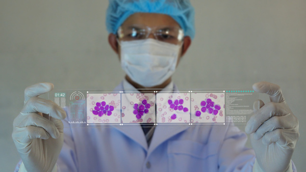 Profissional da saúde segurando uma amostra representativa da leucemia.