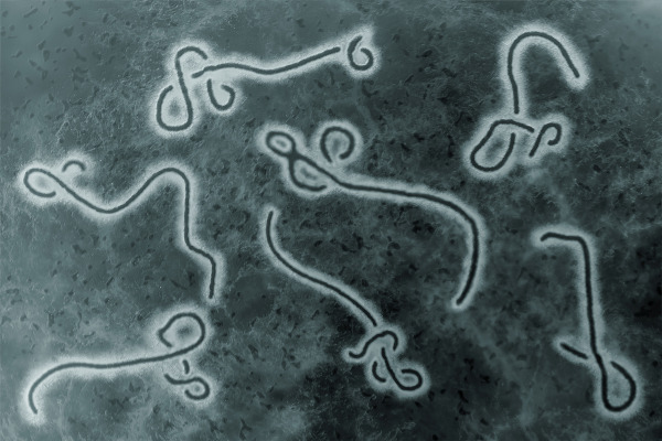 O vírus Ebola é responsável por provocar uma doença grave e altamente letal.
