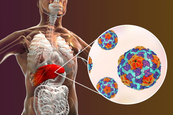 As hepatites virais são doenças que acometem o fígado.