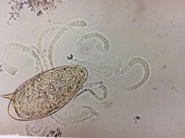 Representação microscópica de ovos de Schistosoma mansoni.