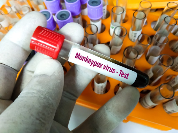 Pessoa com luvas segurando um tubo de amostra de sangue para teste de vírus da varíola dos macacos.