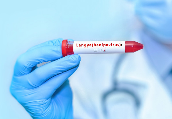 Pessoa da área da saúde segurando um tubo de amostra de sangue que testou positivo para Langya henipavirus.
