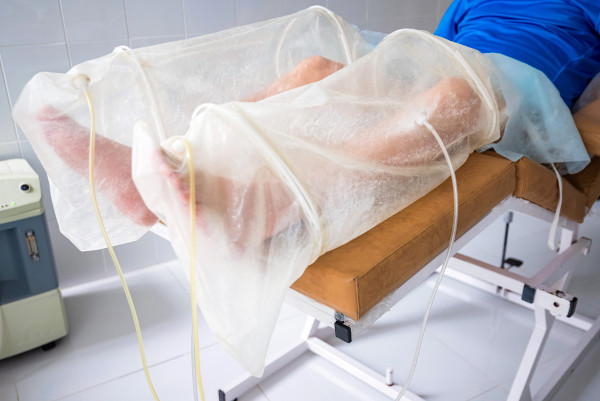 Paciente realizando procedimento de ozonioterapia.