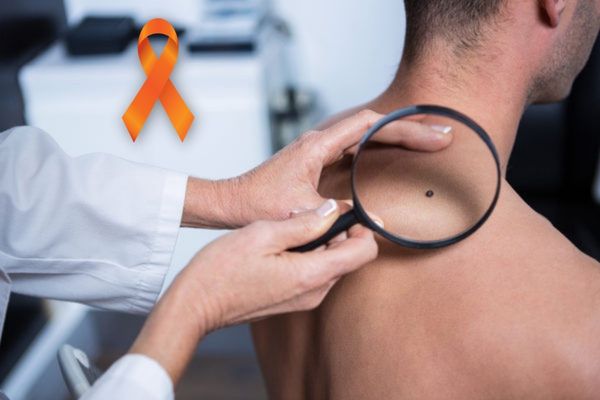 Homem branco sendo avaliado por um dermatologista. Laço laranja símbolo da campanha de conscientização do câncer de pele, o Dezembro Laranja