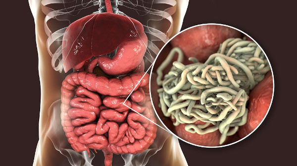 Órgãos do sistema digestório em uma silhueta humana; em destaque, nematódeos parasitas que vivem no intestino.