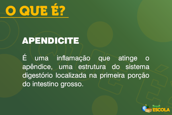 Quadro com o conceito de apendicite.