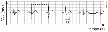 Resultado de um eletrocardiograma em uma questão do Enem sobre ondas.