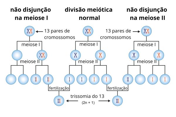 Esquema ilustrativo da não disjunção de cromossomos durante a meiose que causa a síndrome de Patau.