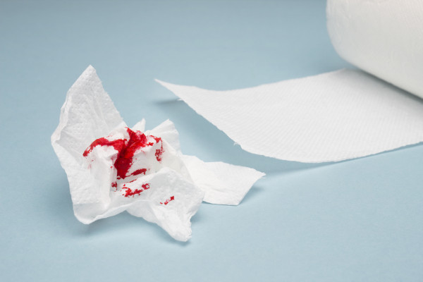 Rolo de papel higiênico com um pedaço de papel simulando estar sujo de sangue em referência à presença de hemorroidas.
