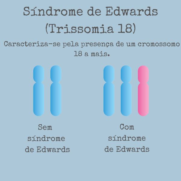 Ilustração mostrando a síndrome de Edwards, alteração genética caracterizada pela trissomia do cromossomo 18.