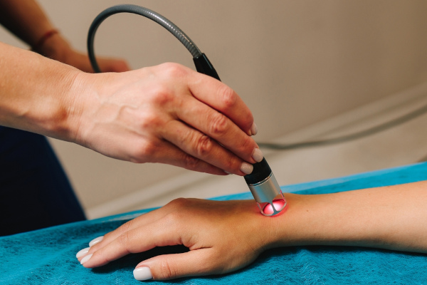 Laser sendo usado em um tratamento dermatológico.