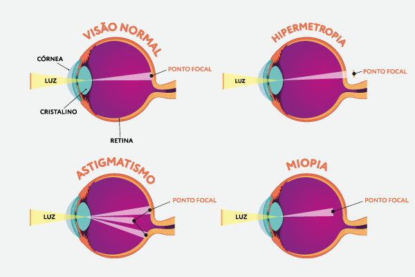 Ilustração representando a miopia, a hipermetropia e a presbiopia, doenças refratárias da visão, um dos cinco sentidos.