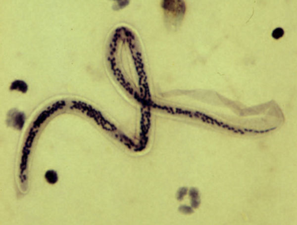 Imagem microscópica do Wuchereria bancrofti, causador da verminose conhecida como elefantíase ou filariose.