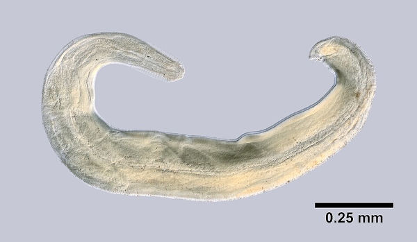 Imagem microscópica do Enterobius vermicularis, causador da verminose conhecida como enterobiose ou oxiurose.