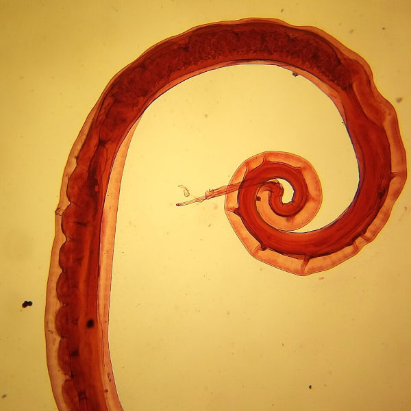 Imagem microscópica do Trichuris trichiura, causador da verminose conhecida como tricuríase ou trococefaliase.