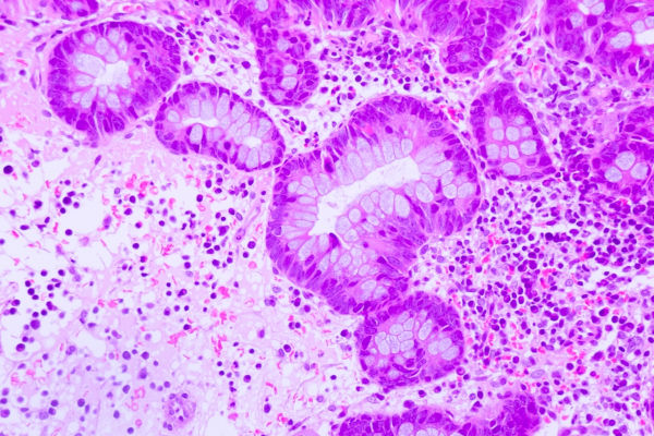 Pluricelularidade representada em um corte histológico de um tecido humano. 