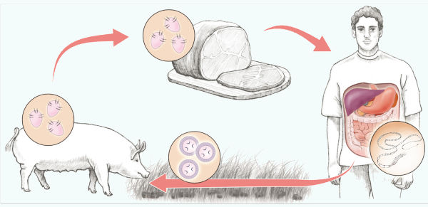 Esquema ilustrativo da transmissão da teníase, doença causada por verme, mostrando um porco, a carne, o homem e o verme.