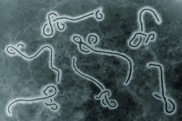 Vírus Ebola