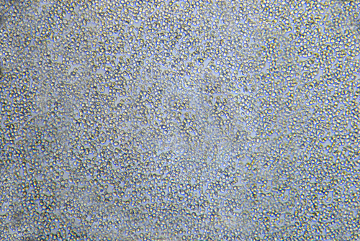 Saccharomyces cerevisiae observados em microscópio