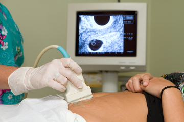 Algumas gravidezes podem evoluir para um quadro de neoplasia trofoblástica gestacional