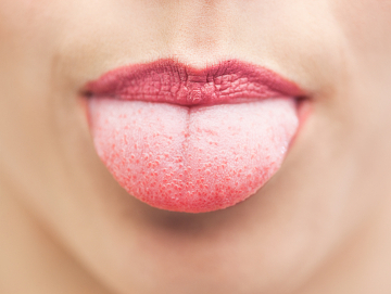 Na língua, são encontrados diversos botões gustativos, que estão relacionados com a percepção dos gostos
