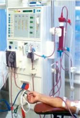 A hemodiálise é feita através de uma máquina que filtra artificialmente o sangue