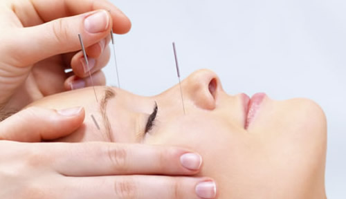 A acupuntura trabalha para harmonizar a energia do corpo.