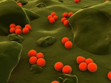 Bactéria Neisseria gonorreae
