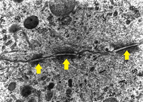 Desmossomos  (sinalizados com setas amarelas) em uma imagem de microscopia eletrônica de transmissão