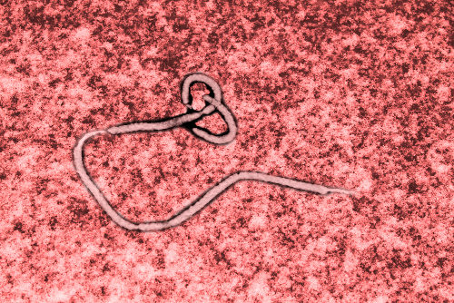 O ebola é um exemplo de vírus e caracteriza-se por sua agressividade, causando a morte de grande parte dos acometidos.