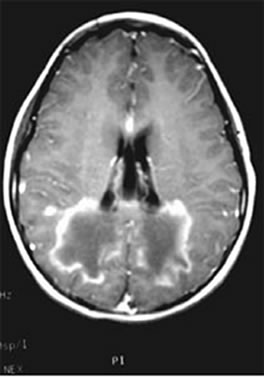 Imagem do cérebro feita por meio da técnica de ressonância magnética