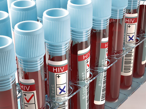 Ser HIV positivo não significa que a pessoa tem Aids
