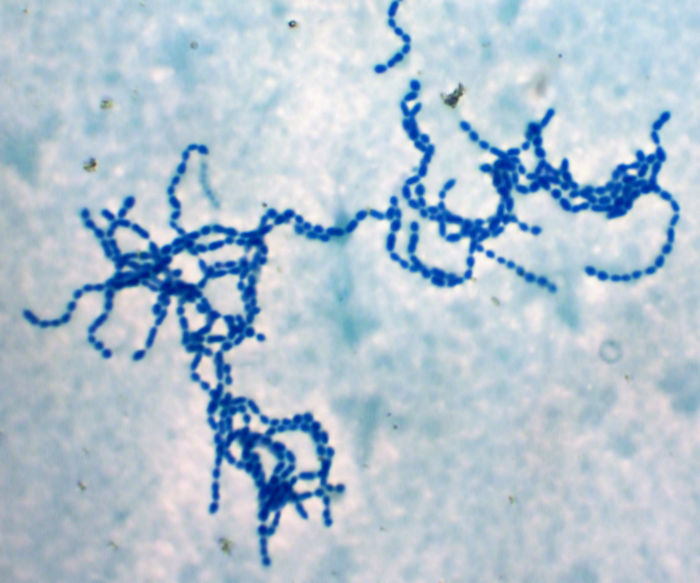Streptococcus pyogenes, causador da febre reumática.