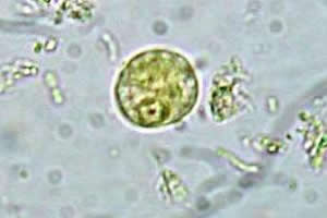 Imagem microscópica do protozoário responsável pela amebíase