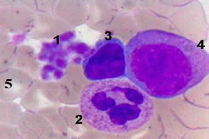1: plaquetas. 2, 3 e 4: glóbulos brancos (neutrófilo, linfócito e monócito, respectivamente). 5: glóbulos vermelhos