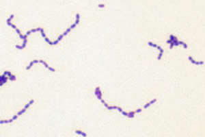 Streptococcus mutans: bactérias responsáveis pela cárie.