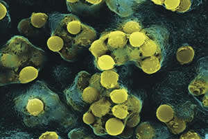 Streptococcus pyogenes: bactéria que pode propiciar o quadro de febre reumática