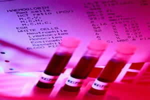 Hemogramas são requeridos para analisar se existem variações quantitativas ou morfológicas nas células sanguíneas do paciente.
