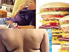 A obesidade atinge milhões de pessoas no mundo