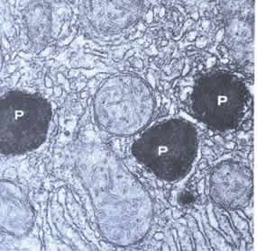 Peroxissomos: vesículas que armazenam a enzima catalase