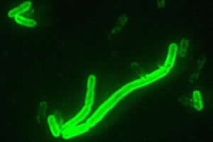 Yersinia pestis: bactéria causadora da peste pulmonar e peste bubônica.