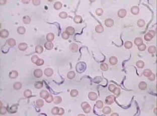 Tripanossoma cruzi (causador da doença de Chagas / transmitida pelo barbeiro), juntamente a células sangüíneas humana.