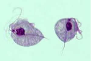 Trichomonas vaginalis: parasita causador da tricomoníase