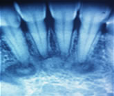 O Cemento protege a raiz do dente