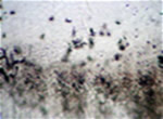 Cementócitos são células aprisionadas na matriz do cemento