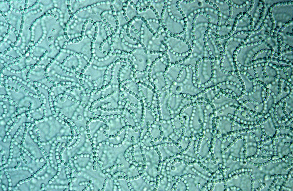 Cianobactérias vistas em um microscópio, exemplos de seres unicelulares.